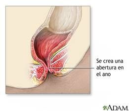 http://www.nlm.nih.gov/medlineplus/spanish/ency/images/ency/fullsize/7136.jpg