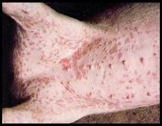https://i0.wp.com/francisco47.files.wordpress.com/2010/11/urticaria.jpg?fit=1000%2C1000