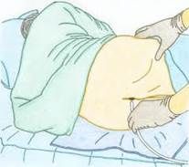 nema o ducha rectal