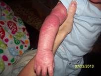 http://hsalud.com/wp-content/uploads/2015/09/3.jpg